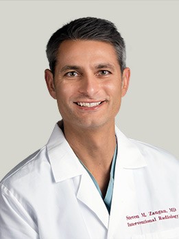 Steve Zangan, MD